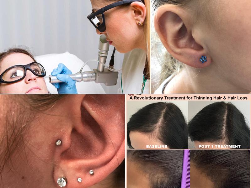 Elsa's Esthetics Electrolysis & Laser, Inc