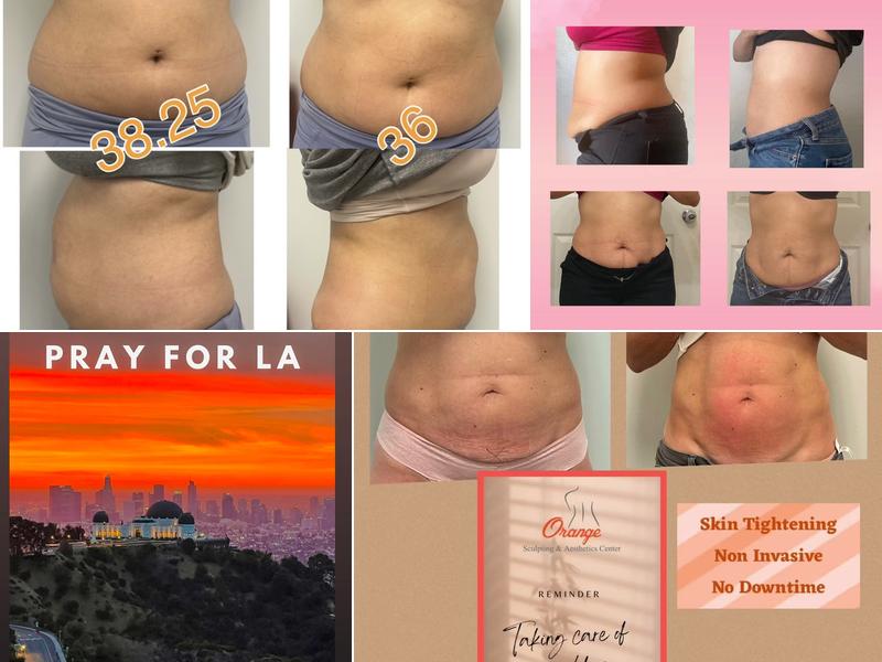 Orange Sculpting & Aesthetics Center