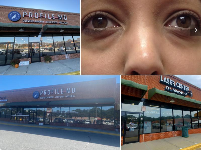 Profile MD by Laser Center of Maryland