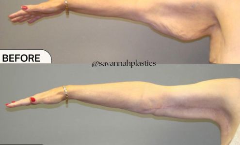 Skin Institute 7208 Hodgson Memorial Dr, Savannah Georgia 31406