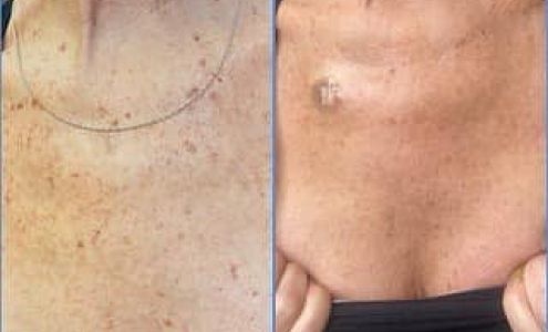 Étage Laser & Skin Care Center