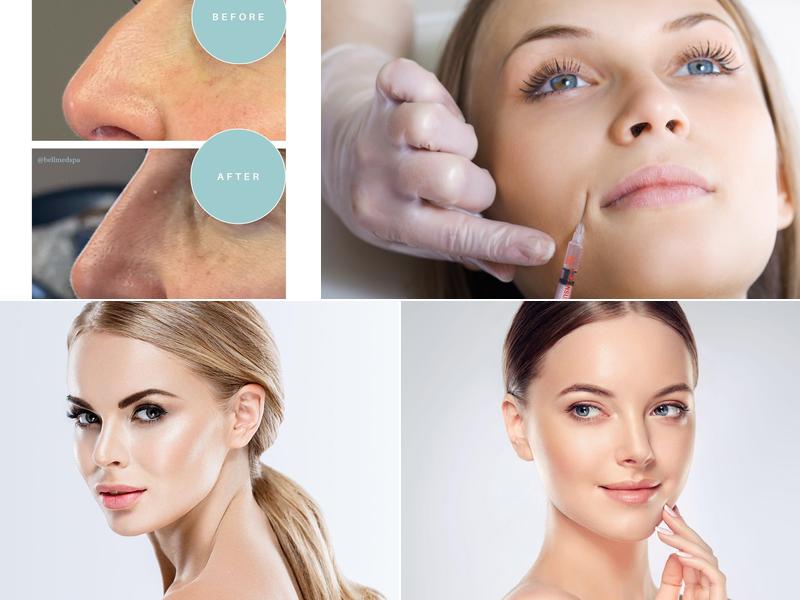 Bella MedSpa