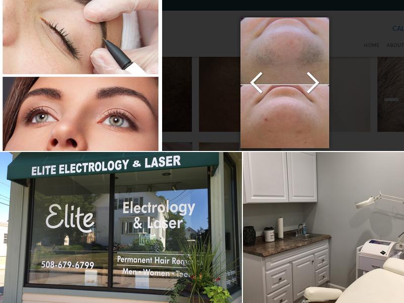 Elite Electrology & Laser Hair Removal