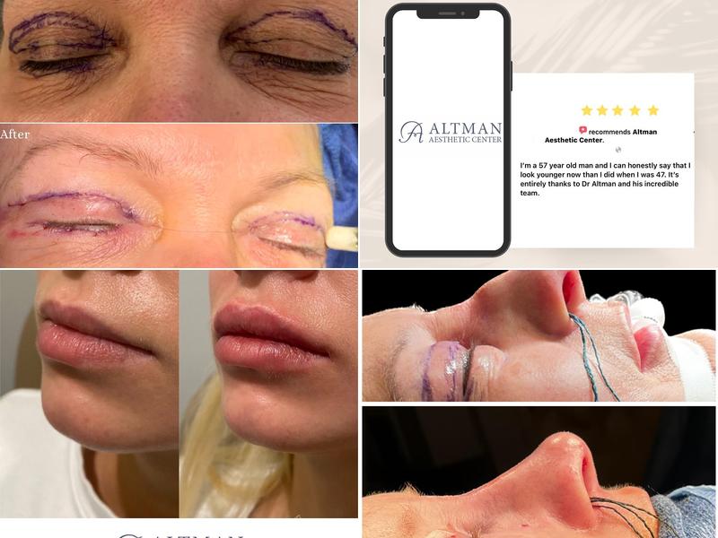 Altman Aesthetic Center: Dr. R G. Altman, MD