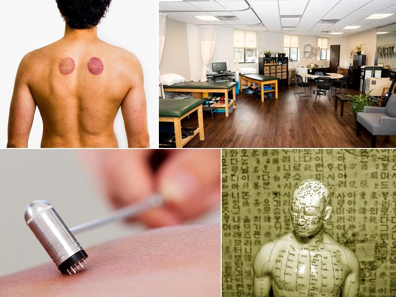 Five Phases Acupuncture PC