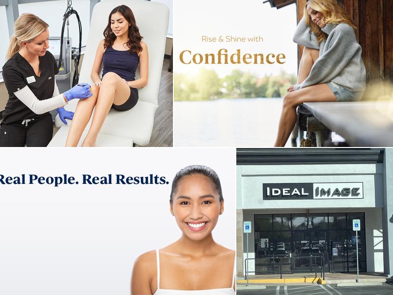 Ideal Image Henderson