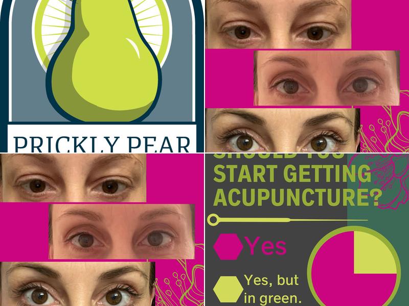 Prickly Pear Acupuncture