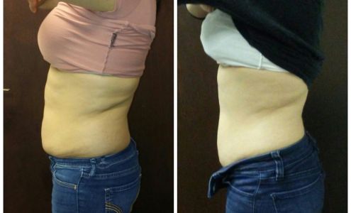 Natural Beauty Sculpting