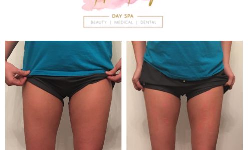 Fit & Fancy Med Spa & School