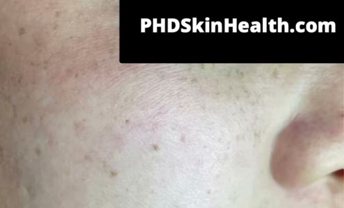 Phd SkinHealth 111 Fashion Ln #220B, Tustin California 92780