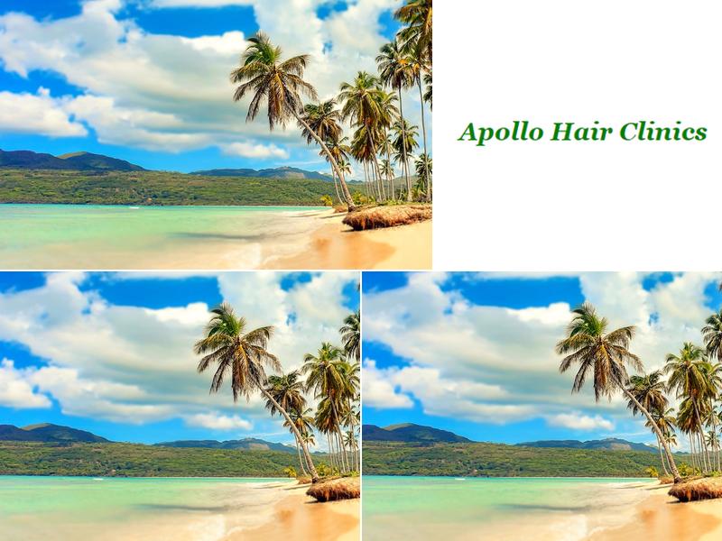 Apollo Hair Replacement