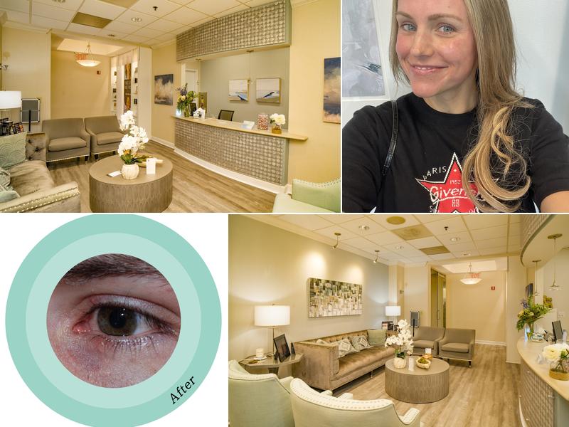 Oculus Plastic Surgery