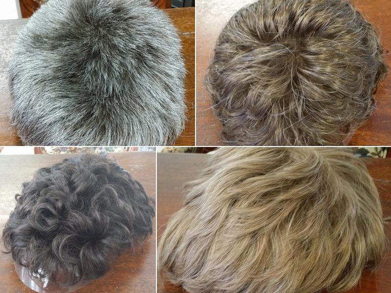 Hair Replacement, for men and women.