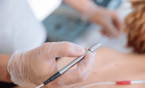 Electrolysis by Estee