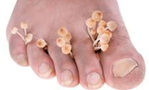 Ny Sports Podiatry