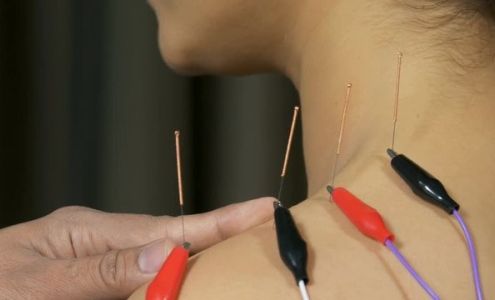 Acupuncture of East Orlando 10967 Lake Underhill Rd STE 109, Orlando Florida 32825