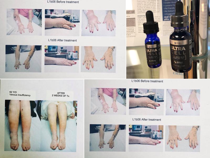 Healing Hands of Lymphatics Plus