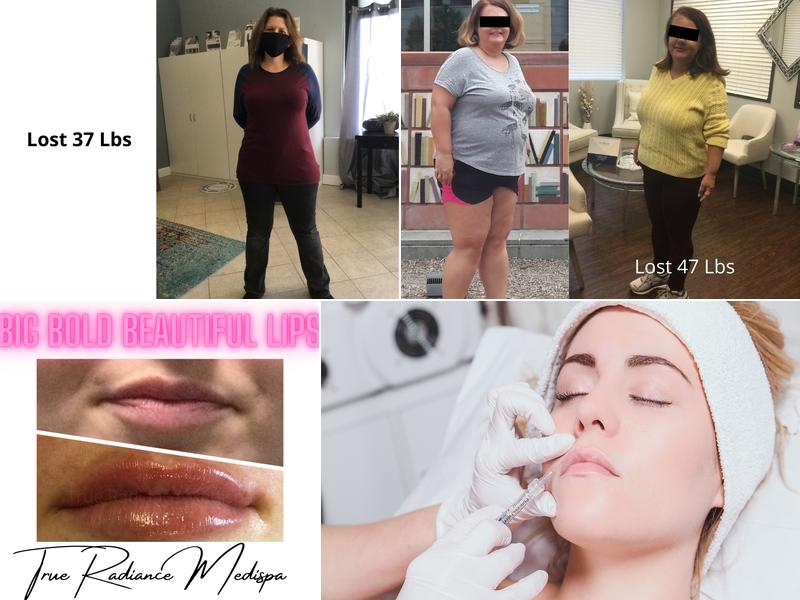 True Radiance Medispa Rocky Mount