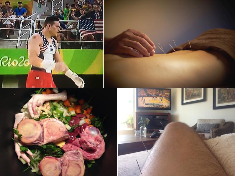 Acupuncture Integration