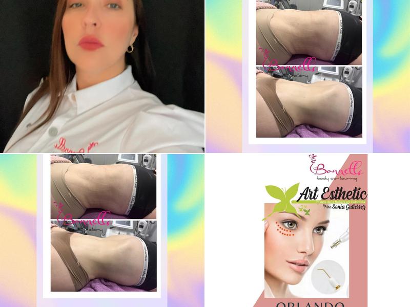 Ebenezer Aesthetic Spa