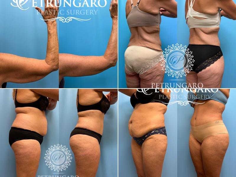 Petrungaro Plastic Surgery