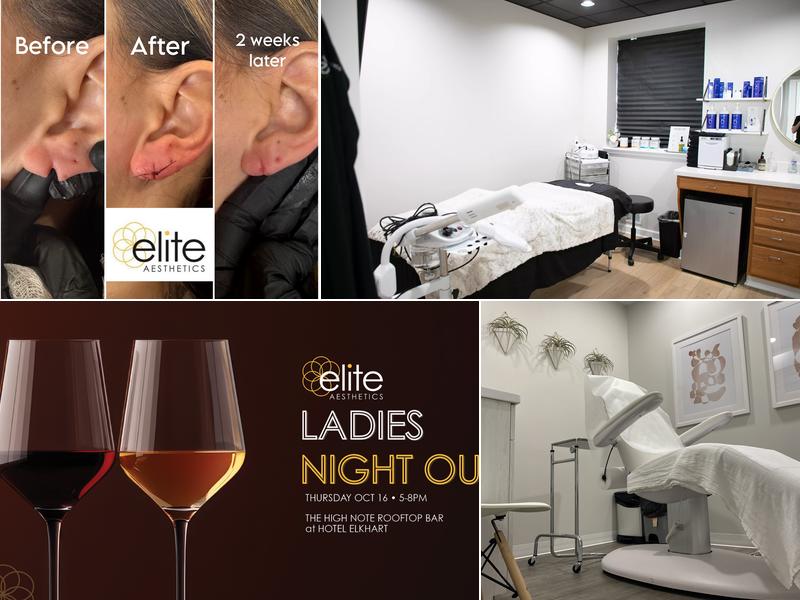 Elite Aesthetics Michiana