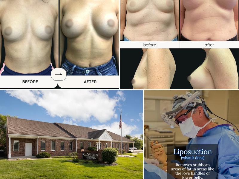 Quinn Plastic Surgery: Dr. John Michael Quinn