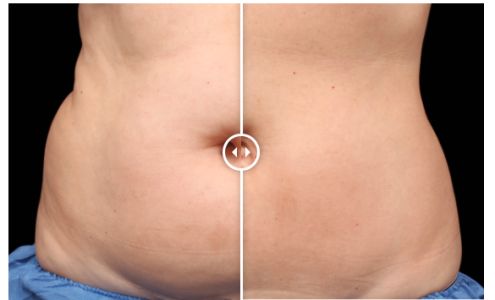 BodiSculpting Specialists