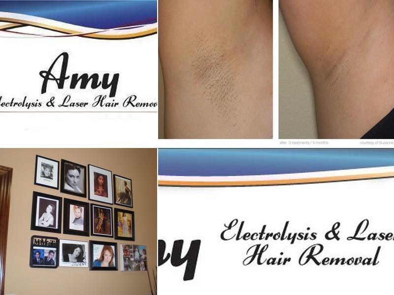 Amy Electrolysis and Laser Hair Removal