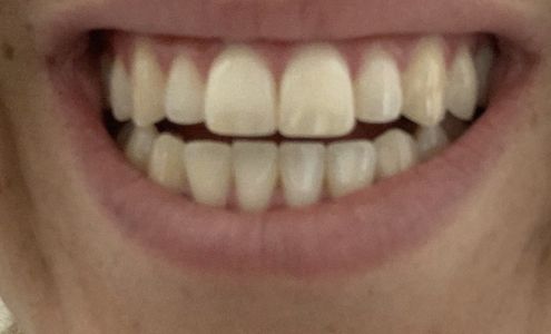 Open and Affordable Dental