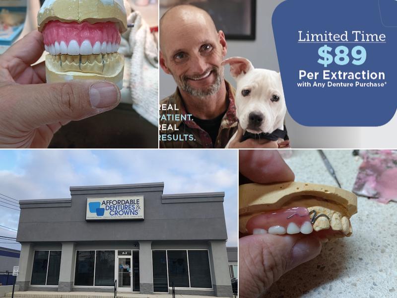 Affordable Dentures & Implants