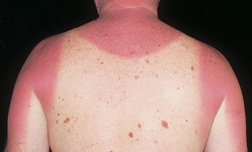 Betty Bellman MD, PA