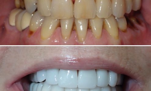 Premier Smile Center 2717 E Oakland Park Blvd #100, Fort Lauderdale Florida 33306