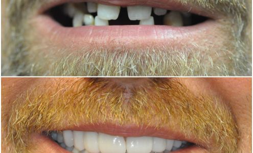 Nashville Cosmetic and Implant Dentistry