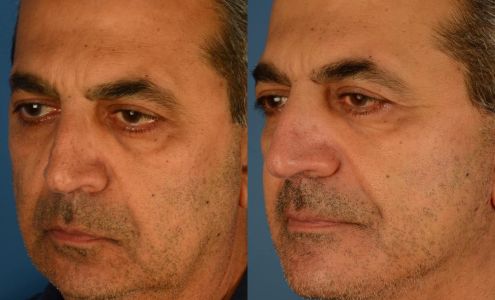 Aesthetic Surgery Center: Anurag Agarwal, MD, FACS