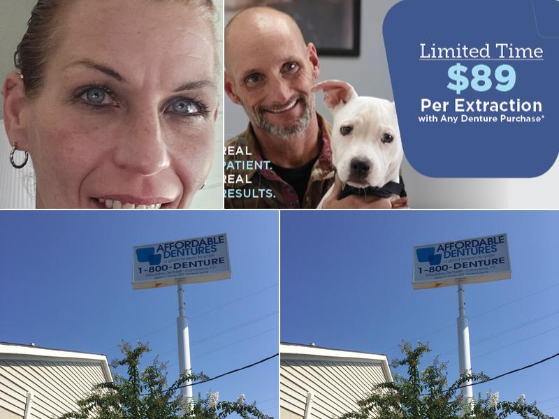 Affordable Dentures & Implants