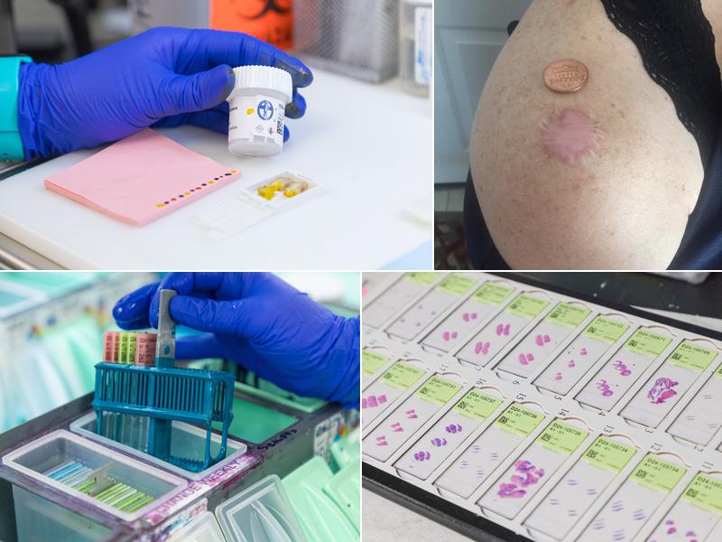 Pinnacle Dermatology- Lab