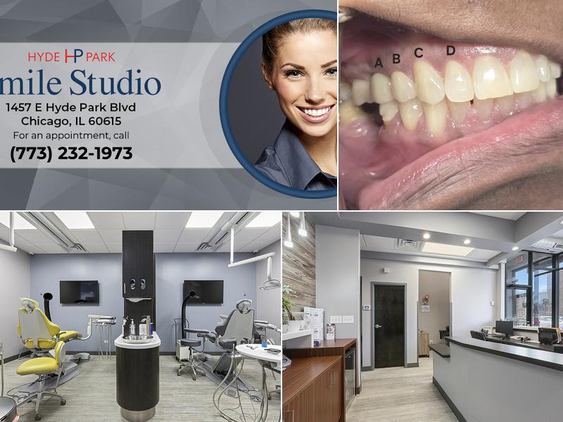 Hyde Park Smile Studio