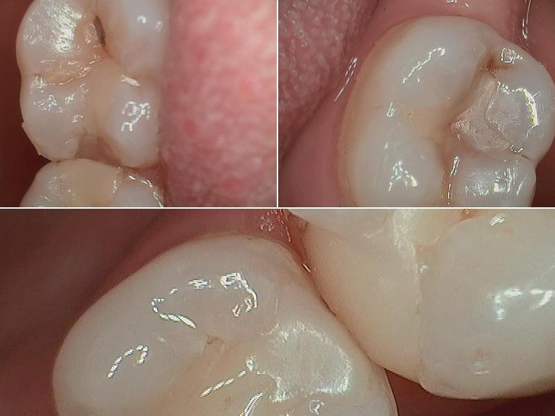 Koehler Melanie A DDS