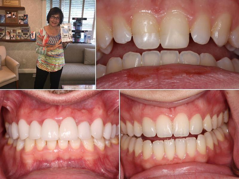 North Salem Dental Care