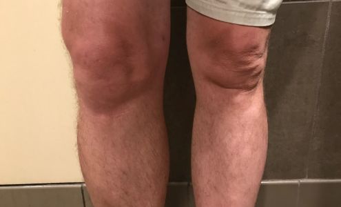 Lexington Family Practice Lake Murray