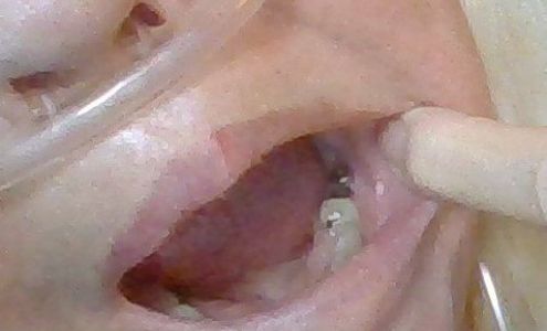 Greenville Family Dentistry: Dr. Christopher Emuedue