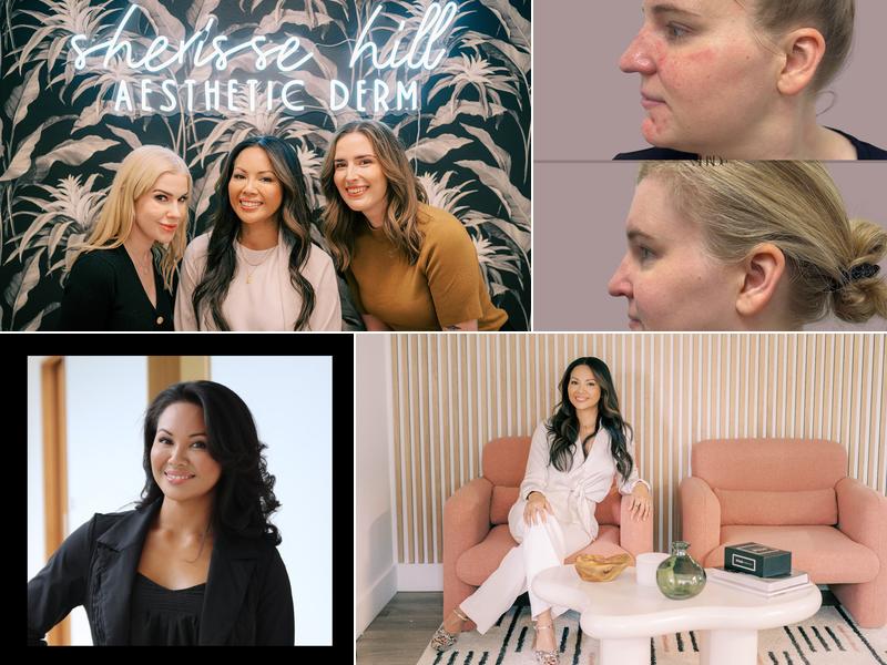 Sherisse Hill Aesthetic Derm