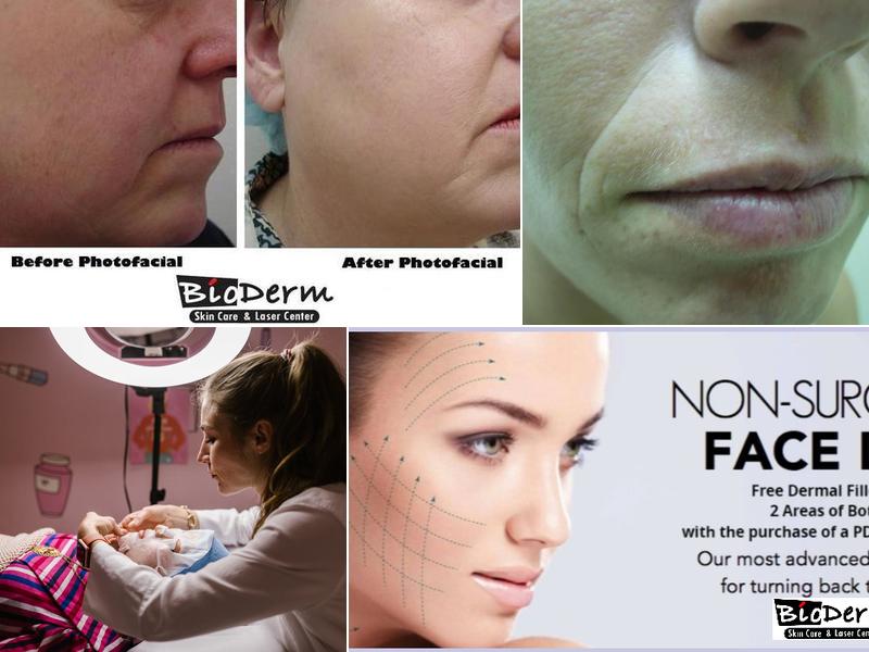 Bio Derm Skin Care & Laser Center