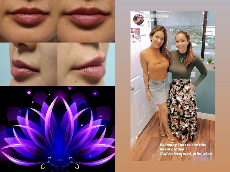 Allure Laser Med Spa LLC/ Allure Derm and Wellness Center