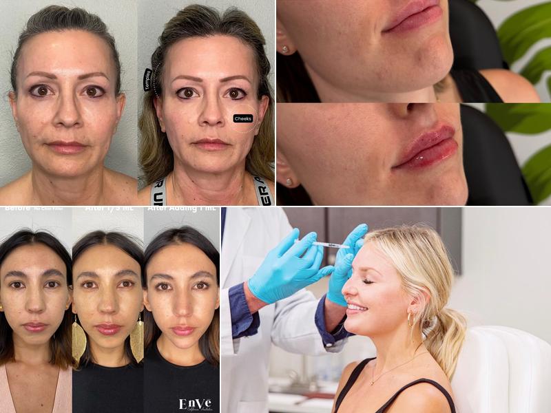 Enve California Aesthetics