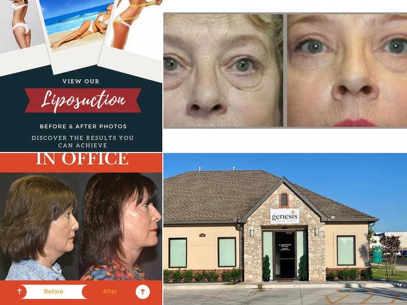 Genesis Plastic Surgery & Medical Spa