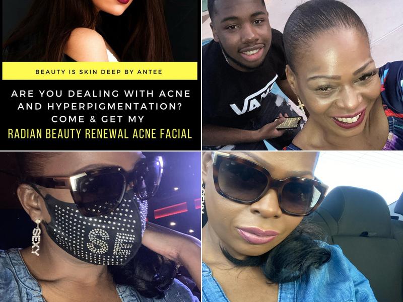 Beauty is Skin Deep by Antee