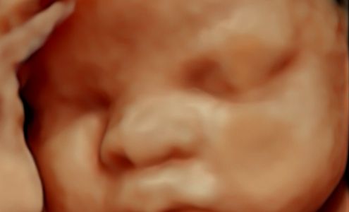 Expecting Miracles, LLC