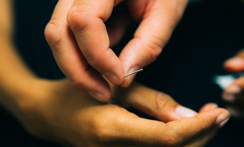 Shine Acupuncture & Wellness